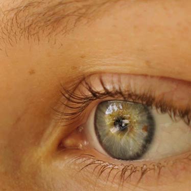 Auge als Symbol für die Website Augenklinik Zürich West